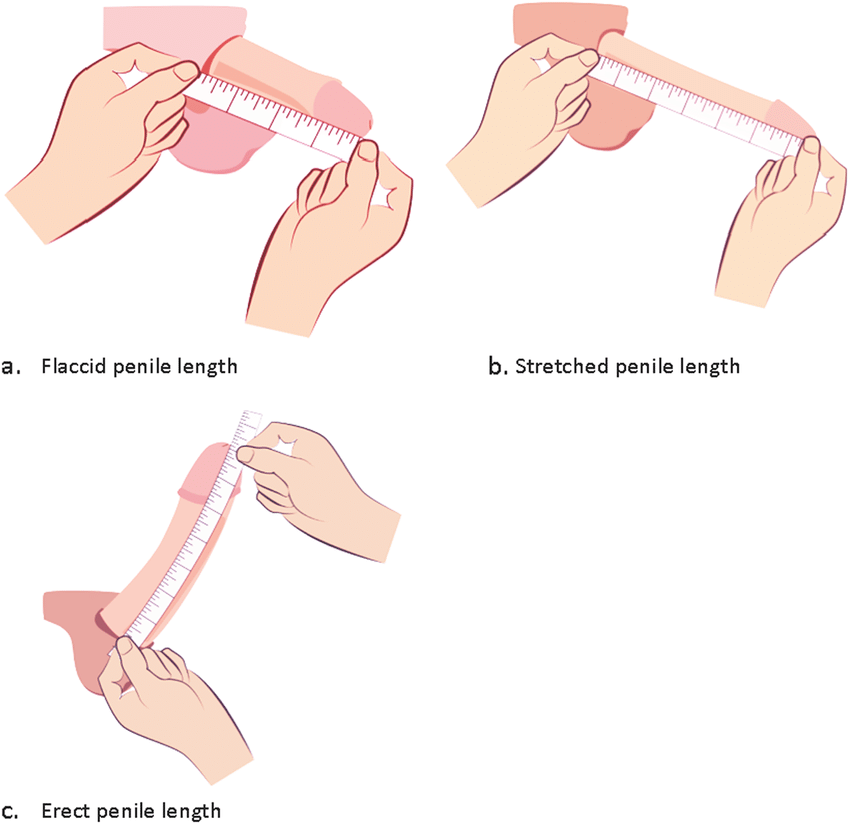 Measurements-of-a-flaccid-penile-length-from-pubo-penile-junction-to-tip-of-the-glans.png